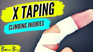 X TAPING METHOD for Climbing Finger Injuries  How to Tape for Pulley Strains and Finger Tweaks [upl. by Herb]