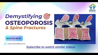 🦴📚Latest Osteoporosis Treatment amp Spine Fractures What a Physician Must Know👨‍⚕️🦴 [upl. by Solram]