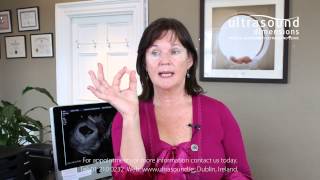 Viability Scan Explained by Specialist Sonographer [upl. by Norod]