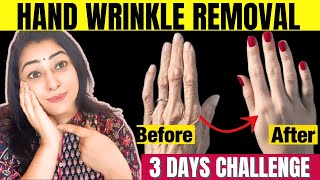 Remove Wrinkles from Hands  Make your Hands Look 10 Years Younger  Get Baby Soft Hands in 3 Days [upl. by Attirb]