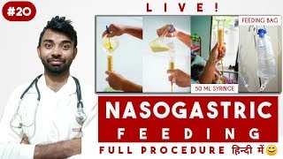 Nasogastric Tube Feeding Procedure  Ryles Tube Feeding Procedure Video In Hindi  passichamp 2020 [upl. by Adniles]