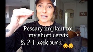 Pessary Implant For Short Cervix amp 24 Week Bump [upl. by Yennor]