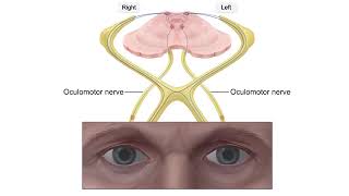 Normal pupillary light reflex [upl. by Granlund798]