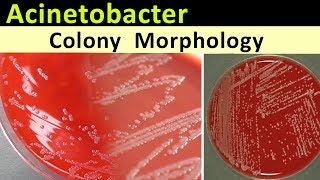 Acinetobacter Colony Morphology [upl. by Enitsirt]