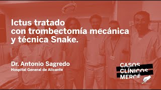 Caso Clínico Mercé 62 Ictus tratado con trombectomía mecánica y técnica Snake HGeneral Alicante [upl. by Lathan823]