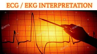 ECG EKG Interpretation Part 4A  Arrhythmias in Ecg [upl. by Oralle]