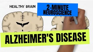 2Minute Neuroscience Alzheimers Disease [upl. by Aissenav911]