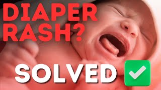 How to treat diaper rash [upl. by Leonora]