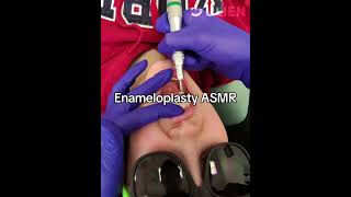 This Dental Procedure Will Tingle Your Senses [upl. by Hayidan]