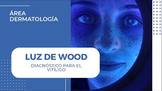 Diagnóstico de quotVITÍLIGOquot con Luz de Wood  Dermaperú [upl. by Ahset]