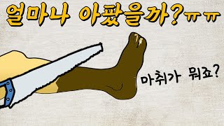 마취제가 없던 시절 절단수술은 어떻게 했을까｜절단수술의 역사와 마취제 혁명 [upl. by Devlin883]