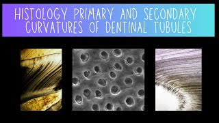 Histology of Primary and Secondary Dentinal Tubule Curvatures  Dentistry [upl. by Tranquada]