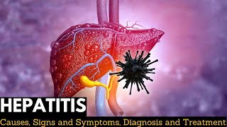 Hepatitis Causes Signs and Symptoms Diagnosis and Treatment [upl. by Earlene]