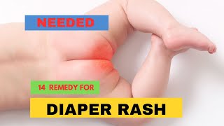 14 HOME REMEDIES FOR BABY DIAPER RASH [upl. by Llerol9]