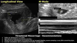 Miscarriage Ultrasound Reporting  Threatened Missed Inevitable Incomplete Types USG Scan Reports [upl. by Eon279]