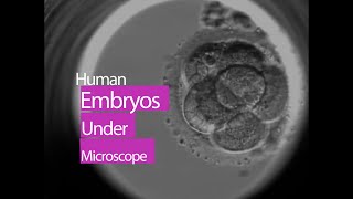 Human Embryo Under Microscope  This is How Life Begins at Conception [upl. by Notsnorb183]