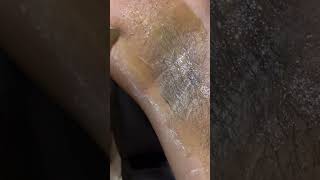 underarms ke balon ko kaise saaf Karen explore trendingshorts waxingtutorial waxing viralvideo [upl. by Ahsirek]