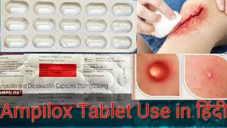 Ampilox capsule in hindi ReviewAmpicillin and Dicloxacillin capsule Review in HindiAmpilox 250 [upl. by Sykleb346]