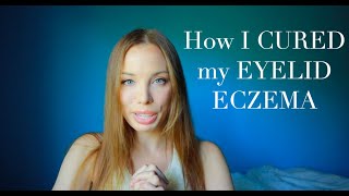 How I CURED my EYELID ECZEMA [upl. by Ihteerp4]