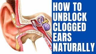 How To Unblock Clogged Ears Naturally  10 Proven Home Remedies for Clogged Ears [upl. by Annayehc]