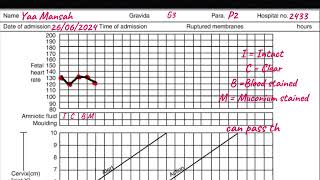 Partograph  How to plot the Partograph A step by step guide griphsacademy2024 [upl. by Atnuahsal]