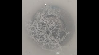 Fungi on and off your body  Morgellons Decease  The silent pandemic  Aspergillus Fumigatus [upl. by Ydoc]