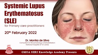 Systemic Lupus Erythematosus SLE for Primary care practitioners  Dr Monika De Silva [upl. by Louisette]