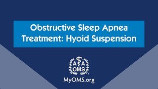 Obstructive Sleep Apnea Treatment Hyoid Suspension [upl. by Nissy]