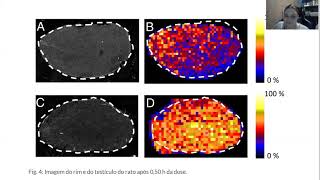 Desorption electrospray ionization mass spectrometry Imaging drugs and metabolitesin tissuesquot [upl. by Batory425]