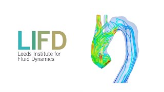 CFD for Personalised vascular interventions  Vanessa Diaz [upl. by Mckale]