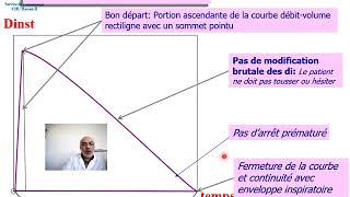 Spirométrie partie 3 résultats et interprétation [upl. by Rizas820]