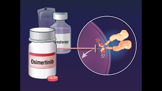 Osimertinib with Chemotherapy in EGFRMutated NSCLC  NEJM [upl. by Bohannon149]