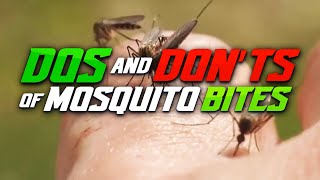 Tips for Soothing a Mosquito Bite [upl. by Eeralih]