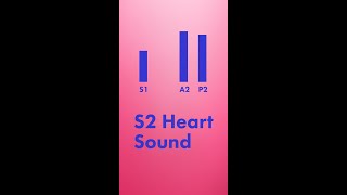 Split S2 Heart Sound  Shorts [upl. by Lletniuq]