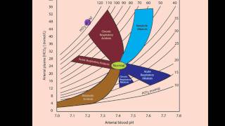 Part 2 Acidosis and Alkalosis Metabolic or Respiratorymp4 [upl. by Heinrike]