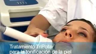 Tratamiento de RadioFrecuencia para la cara y el cuerpo en MAVYPALACIO [upl. by Izabel]