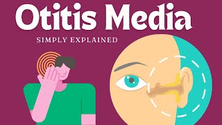 Otitis Media Understanding Ear Infections [upl. by Anigroeg]