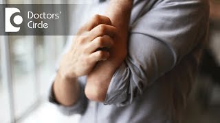 How to manage rashes with severe itching all over the body  Dr Sachith Abraham [upl. by Nolrev]