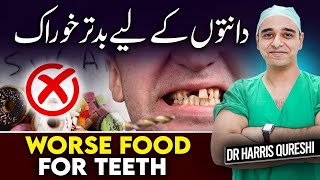 Should Have Worse Food For Teeth  دانتوں کے لیے کیابدتر خوراک  दांतों के लिए सबसे खराब भोजन Drhhq [upl. by Asseralc]