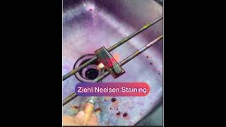 Ziehl Neelsen stainingZN stainingAFB staining Afb tb znstain [upl. by Eive557]