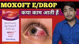 moxoft eye drop use in hindi  moxoft eye drop review [upl. by Elacsap889]