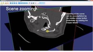 3DimViewer Chapter 2 Basic controls [upl. by Minette]