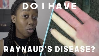 4 Signs You Have Raynauds Disease  You Look Okay To Me [upl. by Nivan]