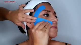 Kinesiotaping Facial aplicación para el quinto par craneal trigémino [upl. by Strawn]