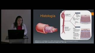 Patología de la Aorta Torácica y los Grandes Vasos Dra Lorena Reyes [upl. by Tessie]