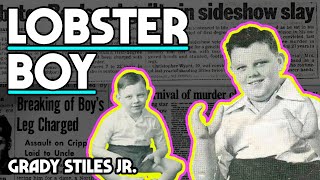 Lobster Boy Grady Stiles Jr [upl. by Whitver]