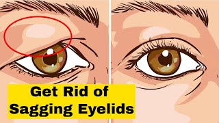 Get Rid of Drooping amp Sagging EYELIDS with These Natural Tips and look Gorgeous every time [upl. by Girovard]