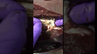 Fasciola hepatica liver fluke adult extraction from a cow [upl. by Ymorej818]