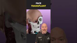 How Face Transplant Surgery Works 🤯 [upl. by Abekam]