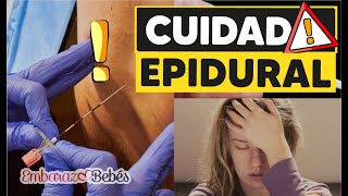 Alerta❗️ EFECTOS de la ANESTESIA EPIDURAL Revelados [upl. by Noelani]